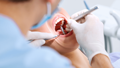 DVT regio 46, ausgeprägter mesialer und distaler periimplantärer Knochendefekt