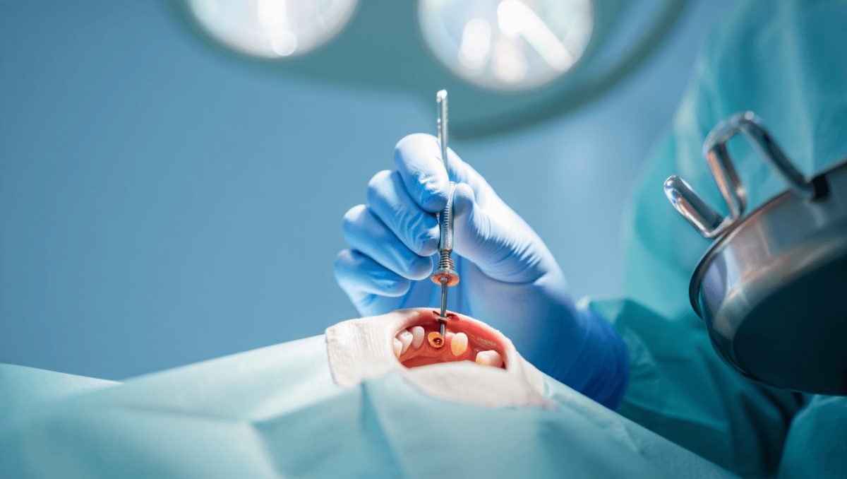 Vollwertige schmale Implantate BioniQ® mit Ø 2,9mm: stabil und prothetisch vielseitig