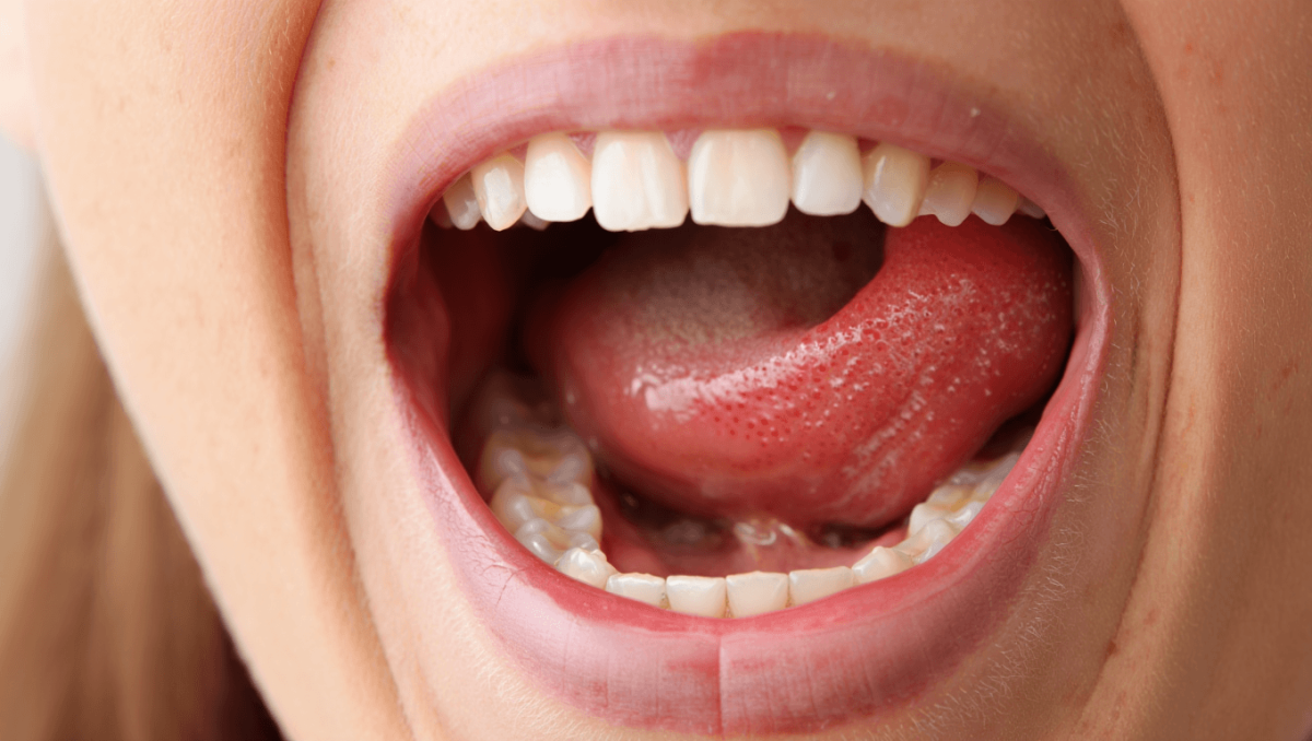 Kartierung des oralen Mikrobioms