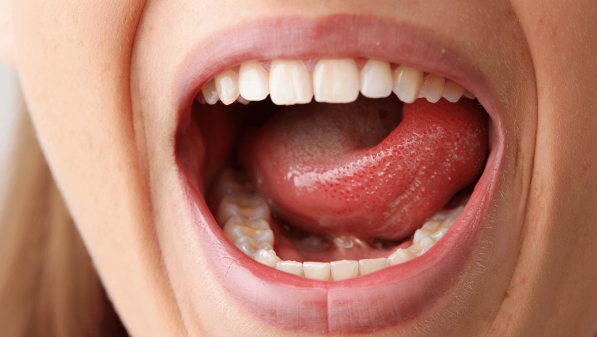 Kartierung des oralen Mikrobioms