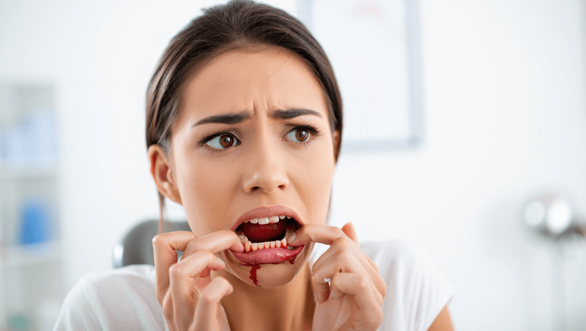 Postbiotische Gummibärchen reduzieren Zahnfleischbluten