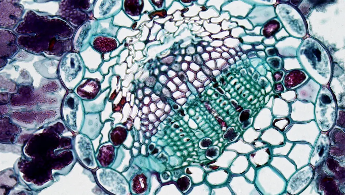 Mikroskopische Darstellung von Entz&uuml;ndungen rund um Zahnimplantate