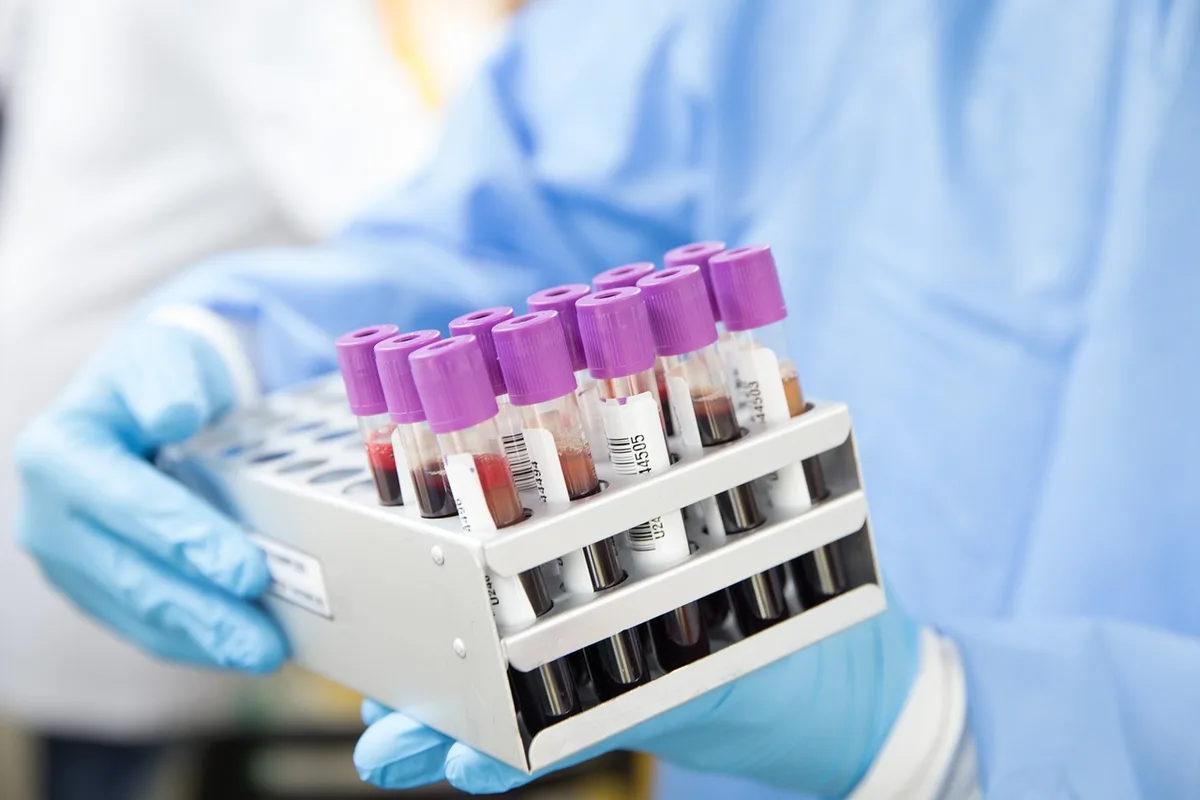 Zentrifuge und PRF‑Röhrchen bei der Herstellung von Platelet Rich Fibrin