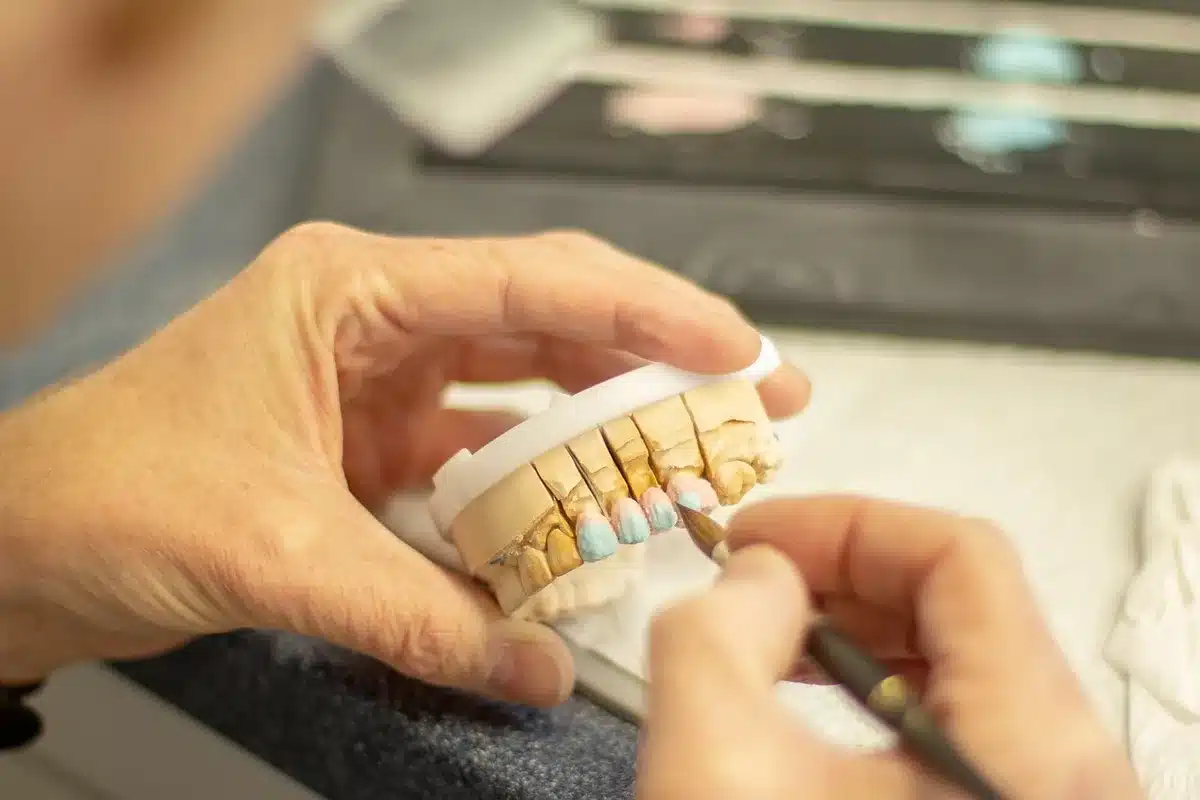 Nahaufnahme eines Intraoralscanners in einer Praxisumgebung