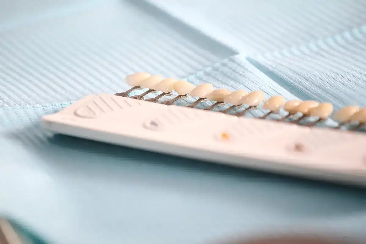 Anonymes Behandlungssetting mit Handschuhen, Instrumenten und Matrizen auf Tablett in heller Praxis