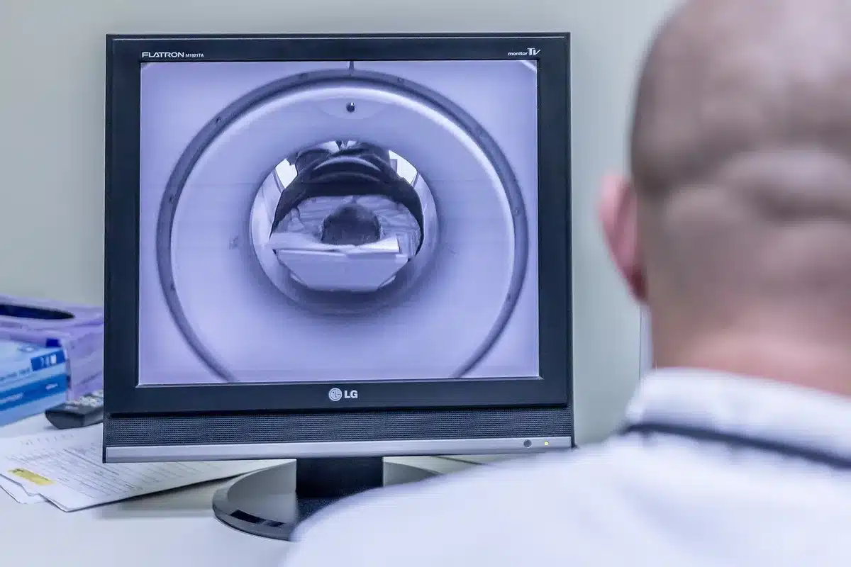 Monitor mit dentaler KI-gestützten Diagnosedaten in der Praxis